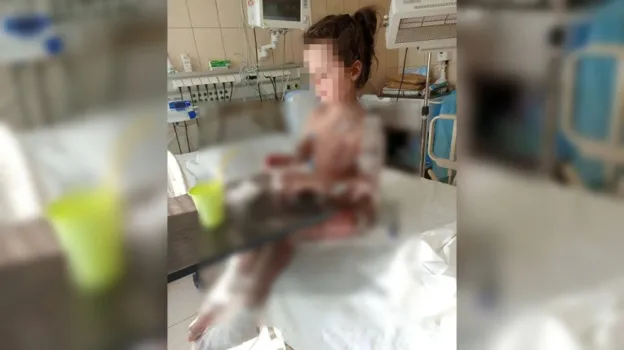 Клиника в Воронеже не признала пациентку в девочке с отслоившейся кожей